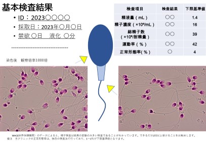 精子検査の基準値について│男性不妊の治療、検査、相談なら「エス