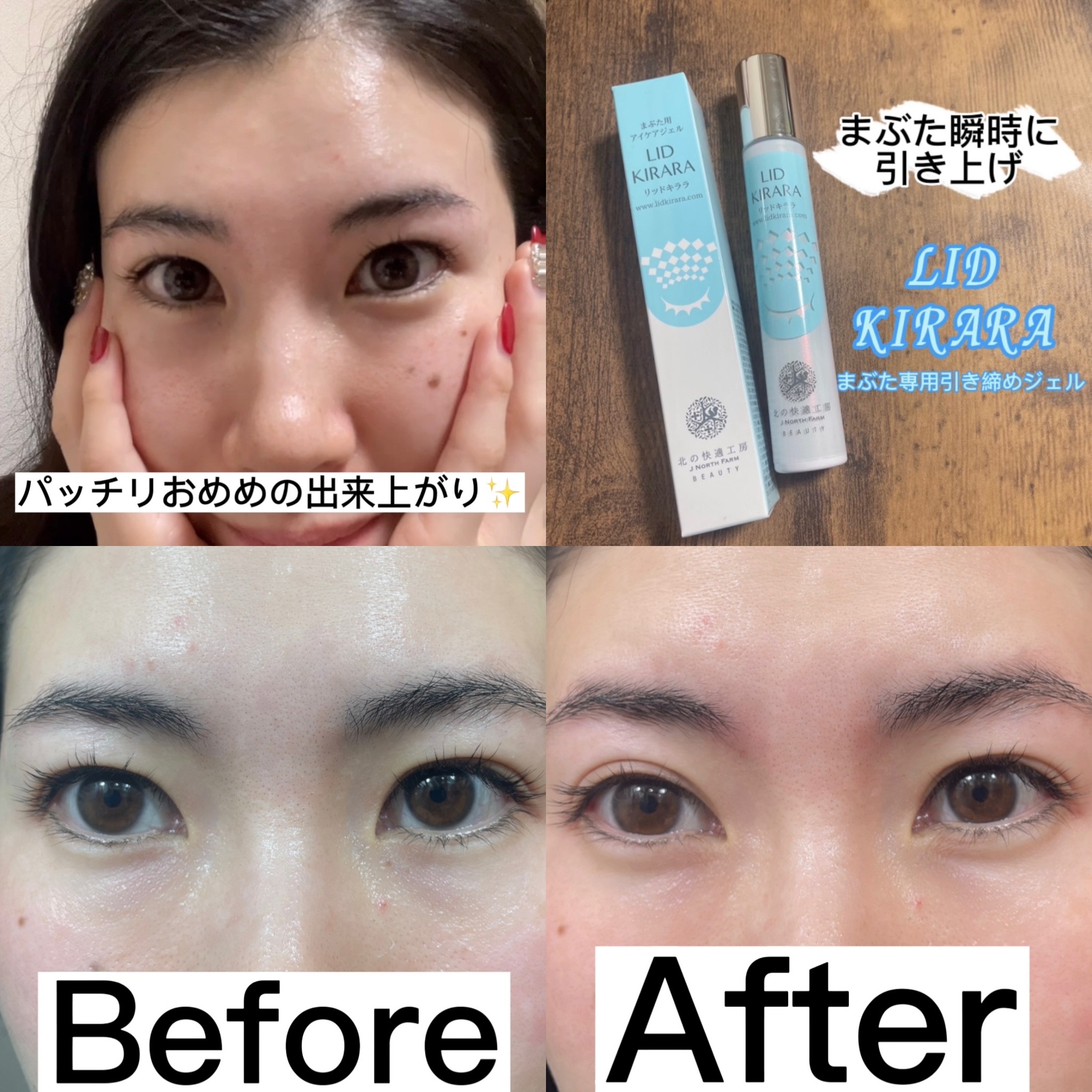✨まぶた瞬時に引き上げ！まぶた専用美容ジェル✨』by SaE💜 : 北の