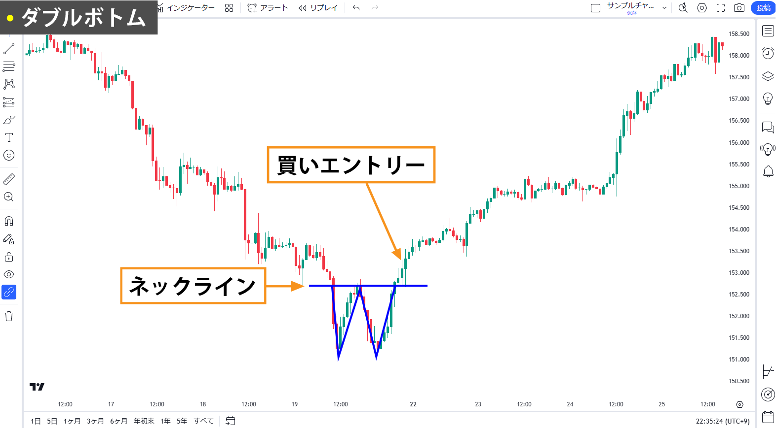 チャートパターン（フォーメーション分析）とは｜初心者向けに代表的な
