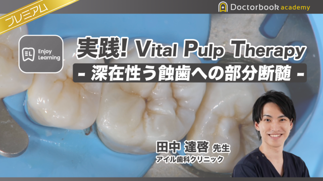 実践！Vital Pulp Therapy 〜深在性う蝕歯への部分断髄〜 | Doctorbook