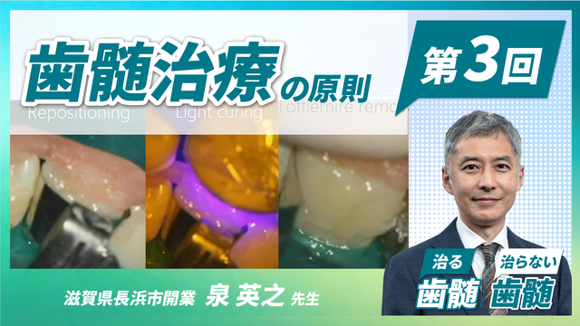 全27動画】泉英之先生オンラインコース「治る歯髄 治らない歯髄 - 歯髄
