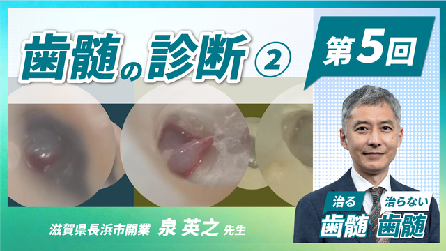 治る歯髄 治らない歯髄 - 歯髄保存の科学と臨床 - 第4回 「歯髄の診断