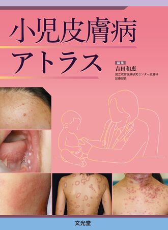 小児皮膚病アトラス | 株式会社文光堂