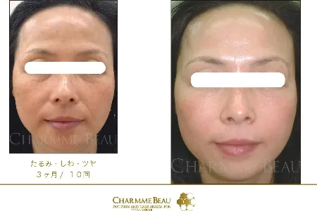 シャルム・ボー