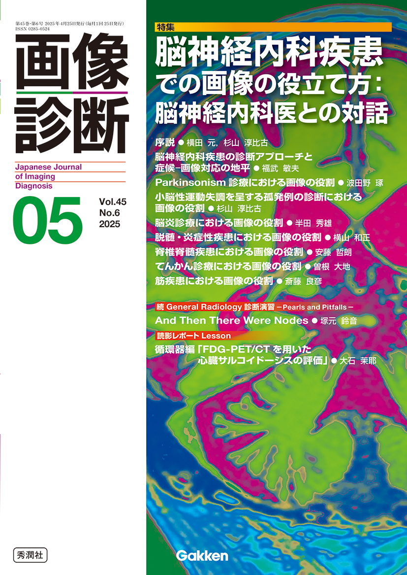 画像診断 Vol.45 No.6（2025年5月号）【電子版】 | 医書.jp
