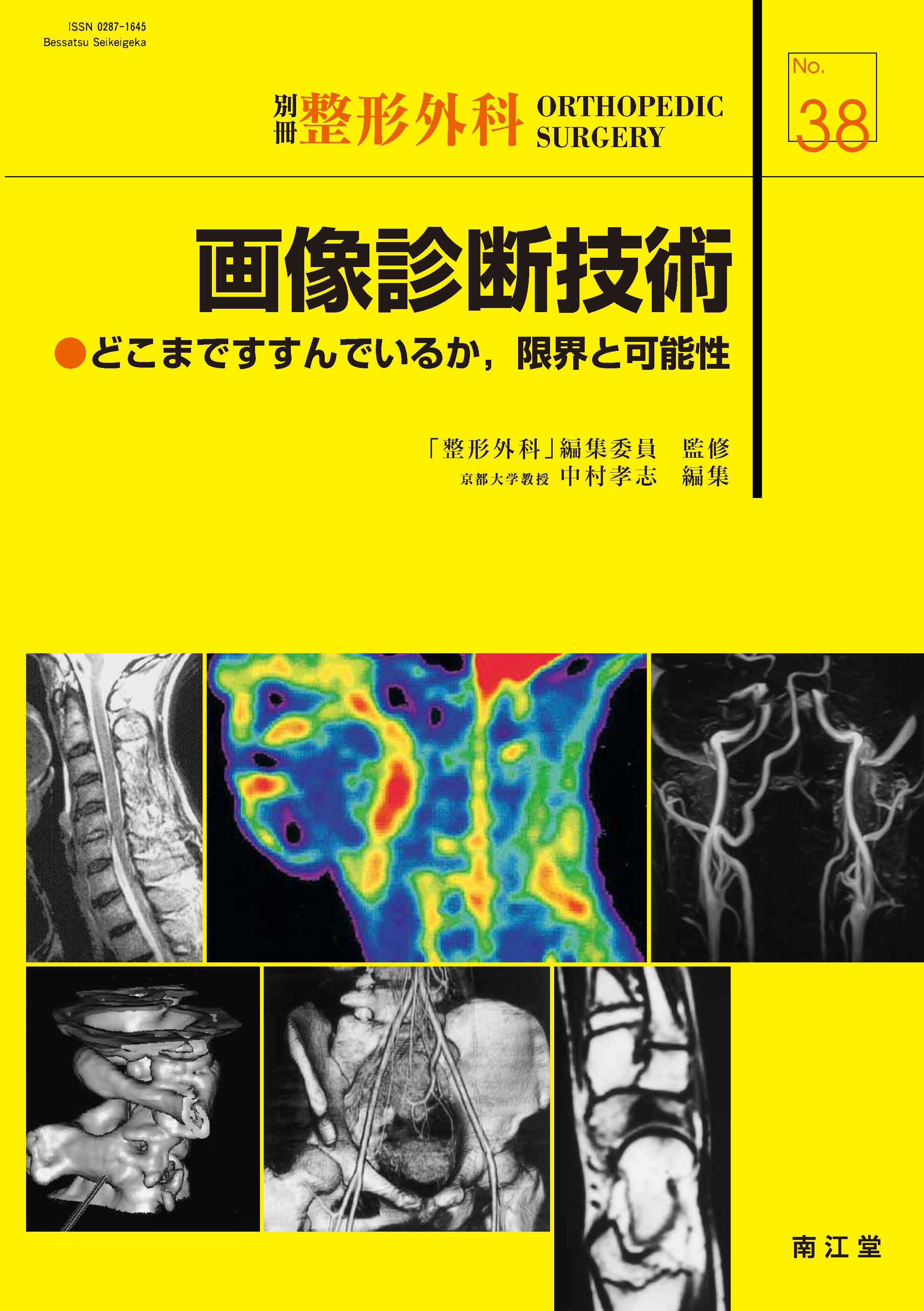 別冊整形外科 No.38 画像診断技術【電子版】 | 医書.jp