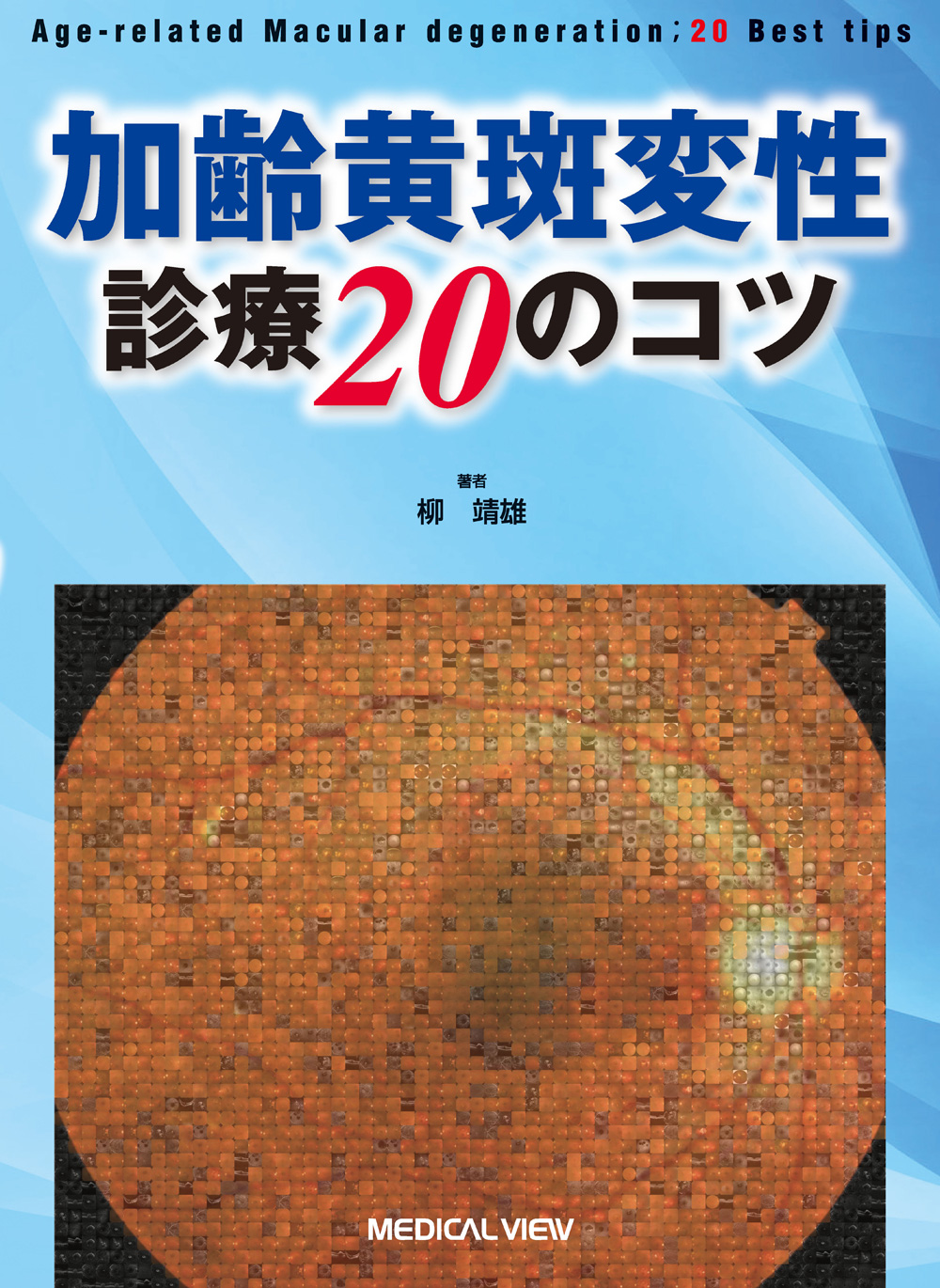 加齢黄斑変性 診療20のコツ【電子版】 | 医書.jp