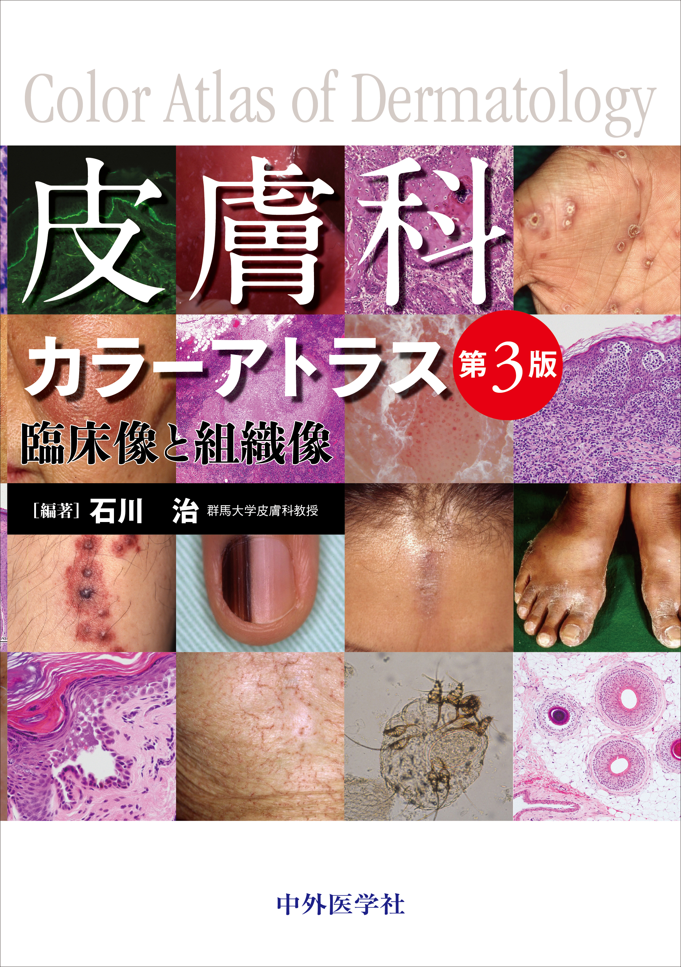 皮膚科カラーアトラス第3版【電子版】 | 医書.jp
