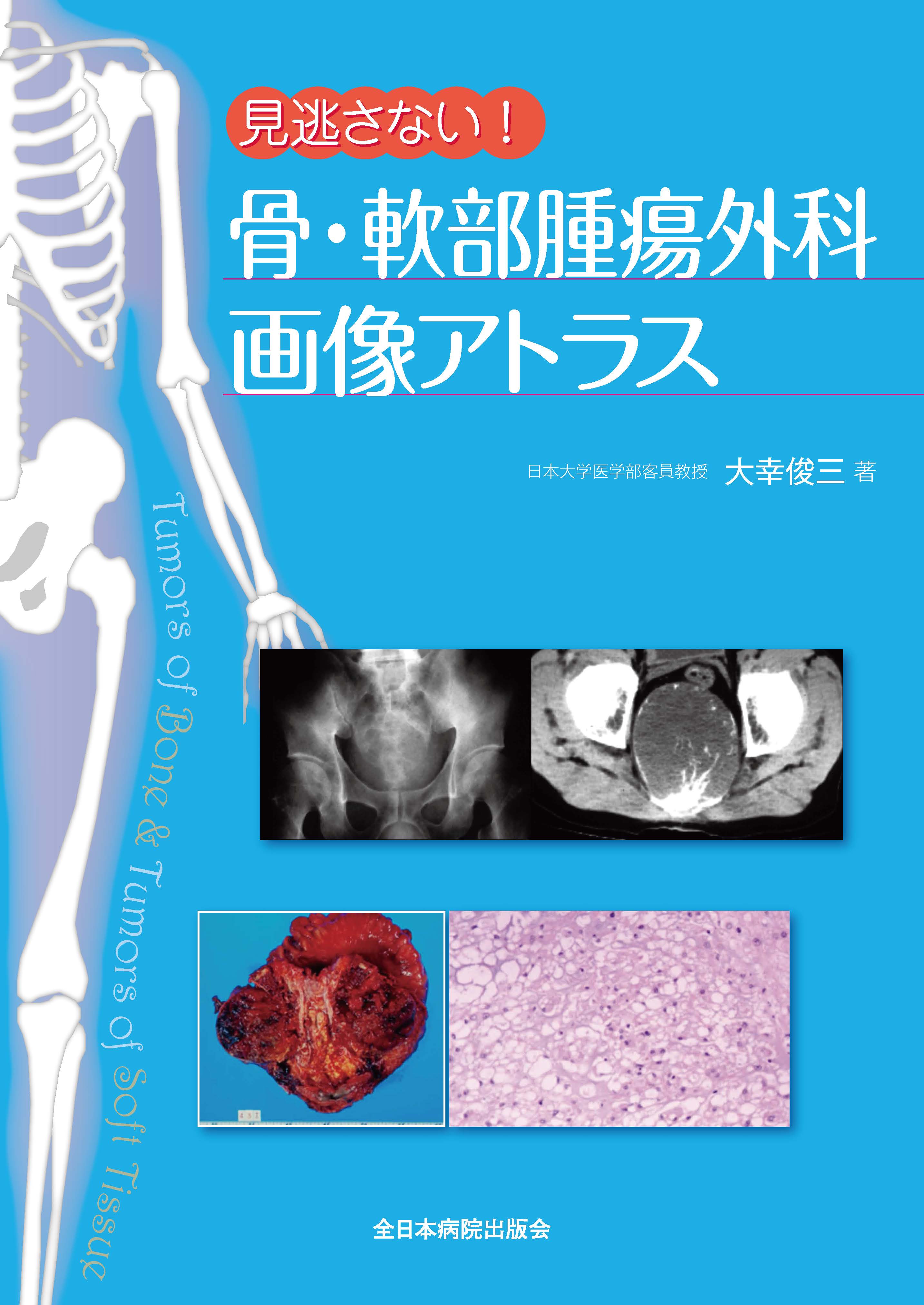 見逃さない！骨・軟部腫瘍外科画像アトラス【電子版】 | 医書.jp