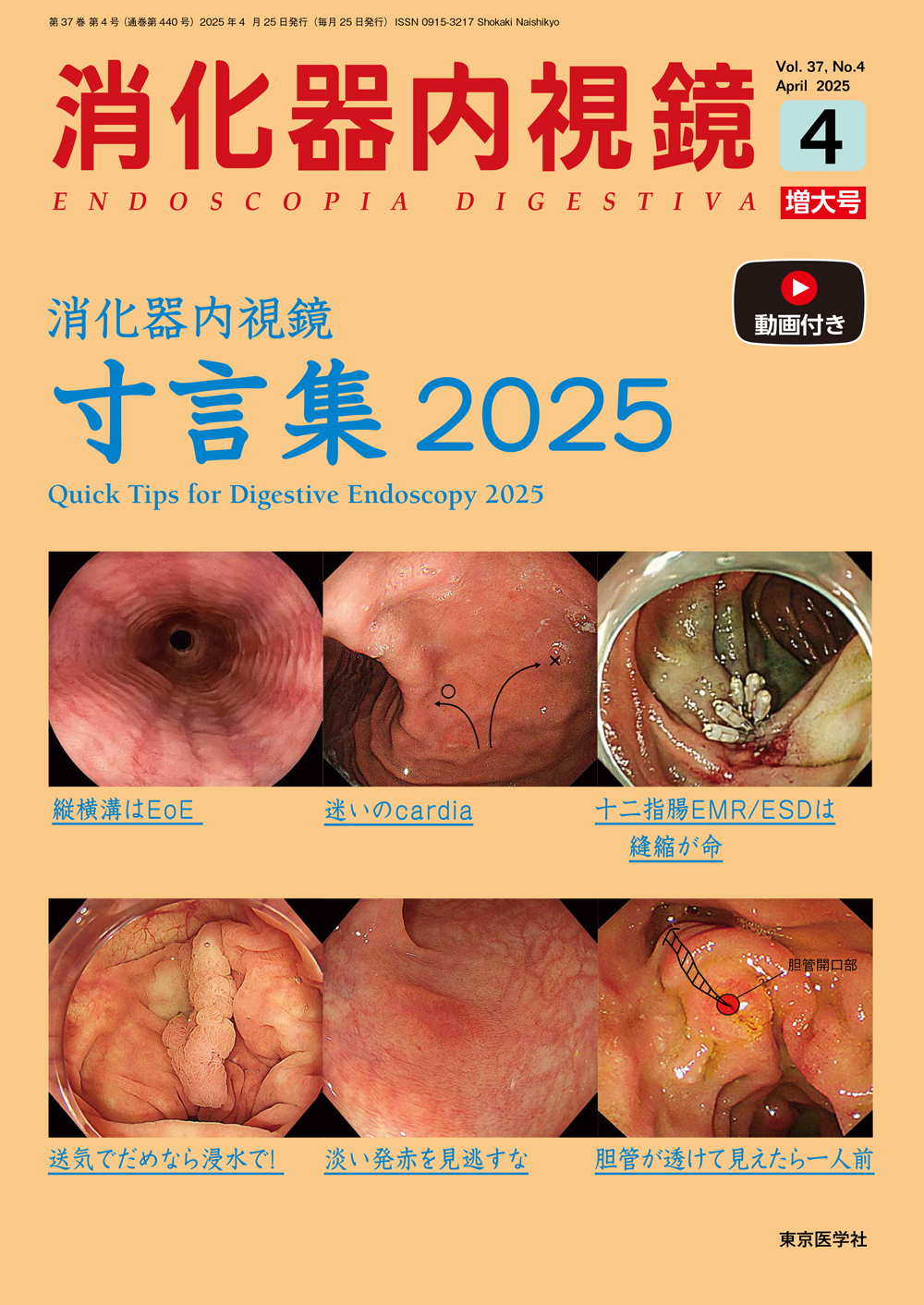 消化器内視鏡37巻4号4月増大号【電子版】 | 医書.jp