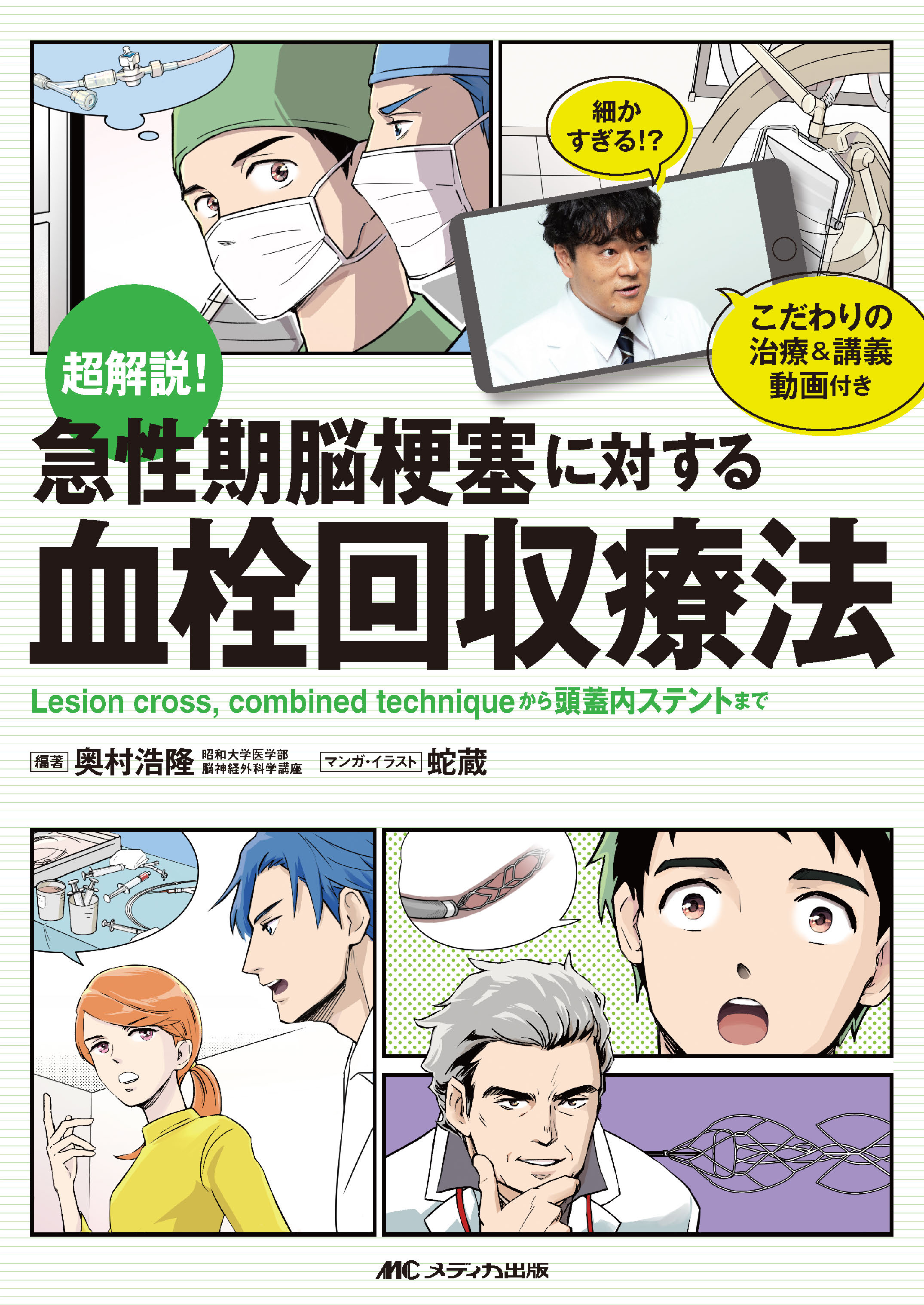 超解説！ 急性期脳梗塞に対する血栓回収療法【電子版】 | 医書.jp