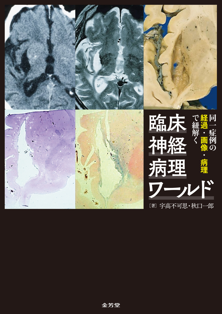 同一症例の経過・画像・病理で紐解く 臨床神経病理ワールド【電子版