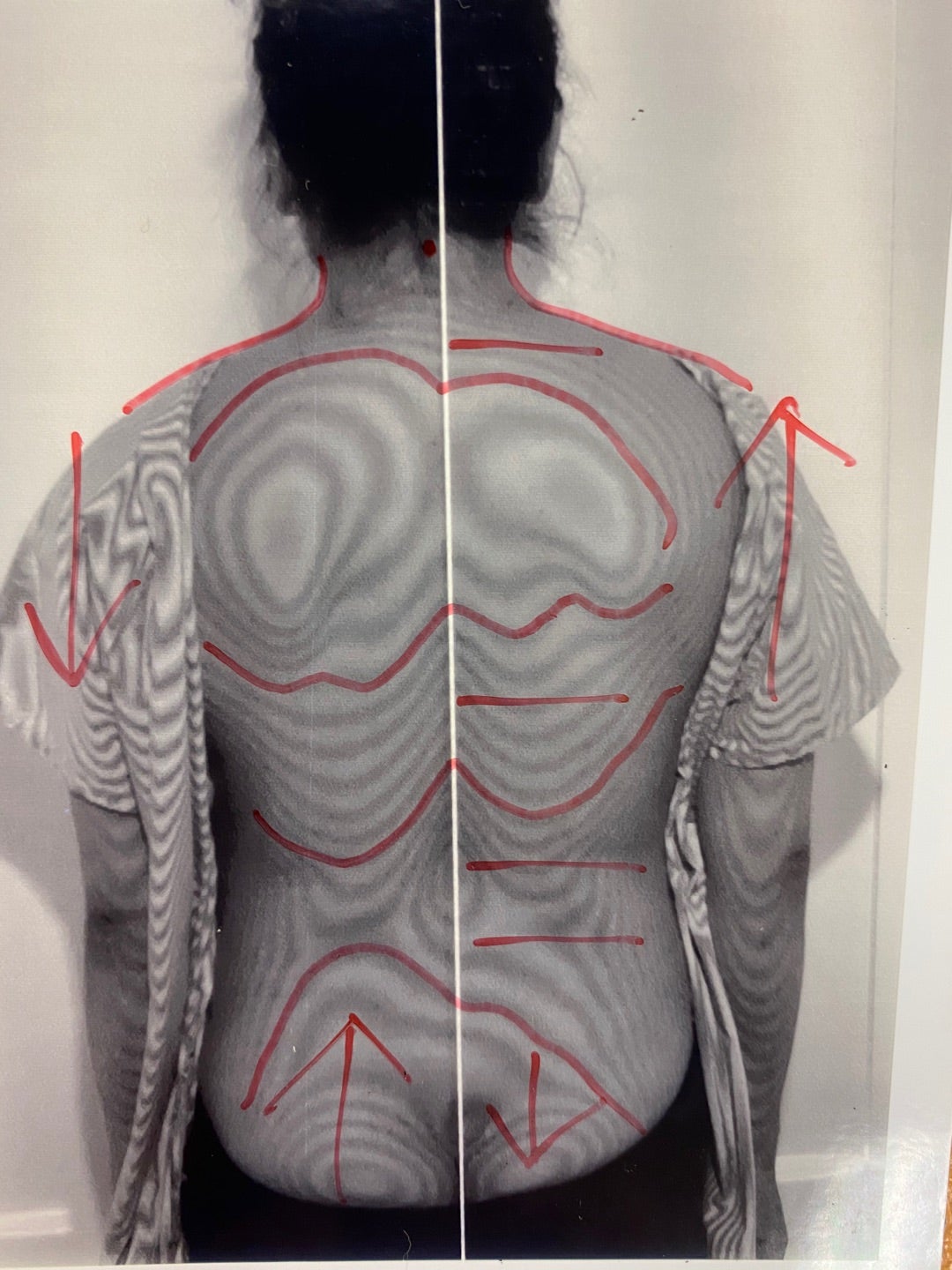 激安！モアレトポグラフィー モアレ 姿勢 分析 等高線 整体 歪みチェック