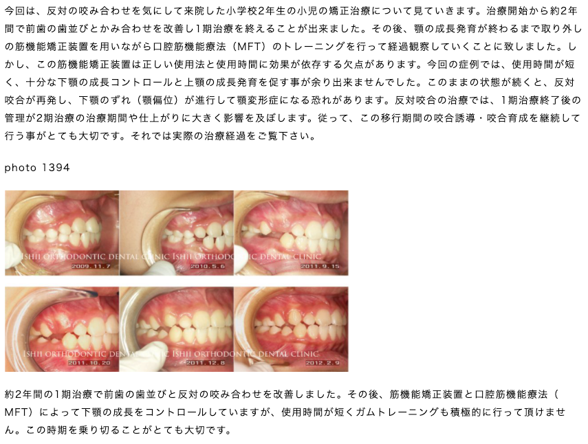 1期治療終了後の筋機能矯正装置によるコントロールの限界 【album 248