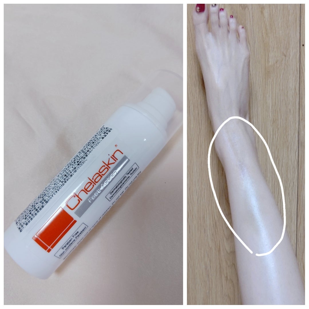 内出血を軽くするケラスキンクリーム(ﾟοﾟ人)) | ナースC子の毎日美容