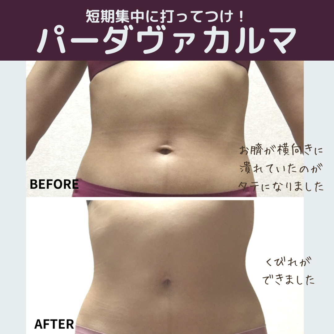 8月限定！Special キャンペーン【痩せたい方へ】塗るだけボディ