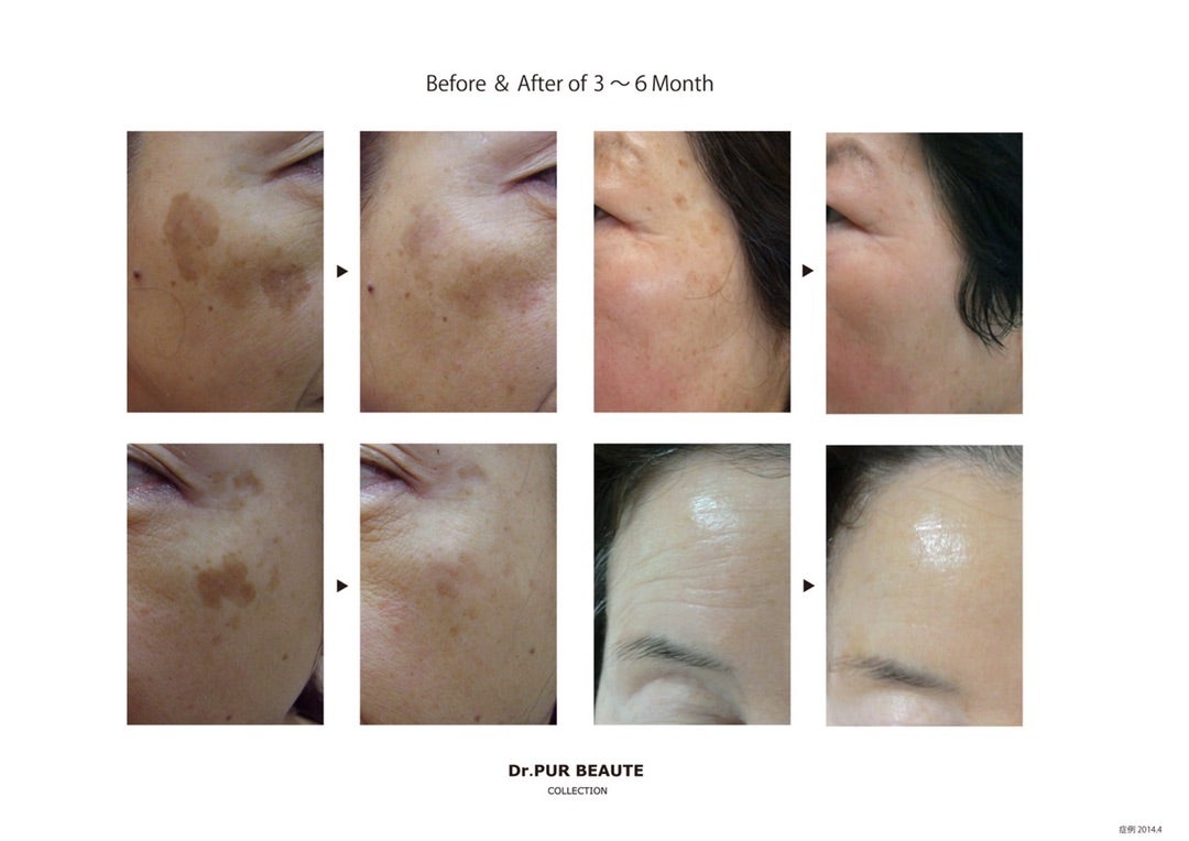 Dr.PURピュールボーテ【#10化粧水】美容皮膚科クリニック提携エステ