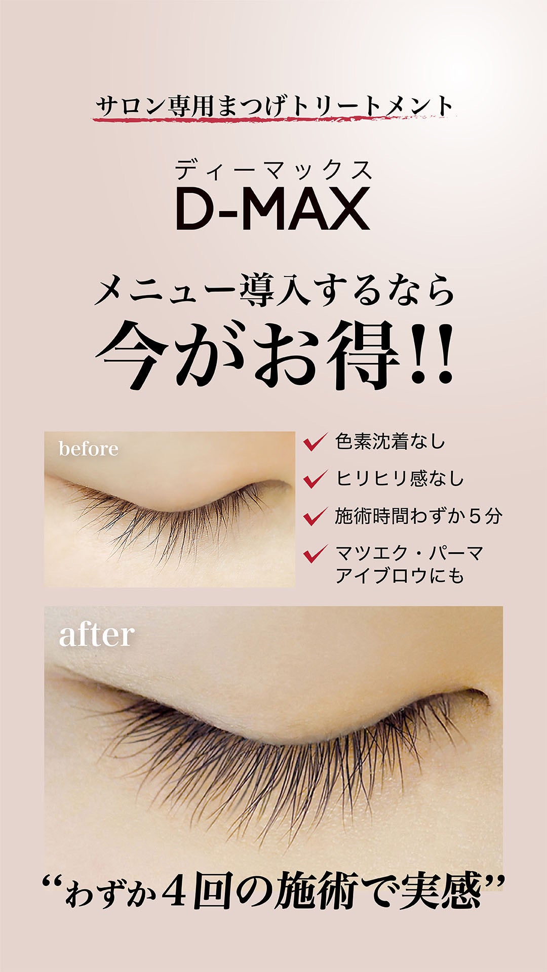 サロン専用まつげトリートメントを導入するなら今がチャンス