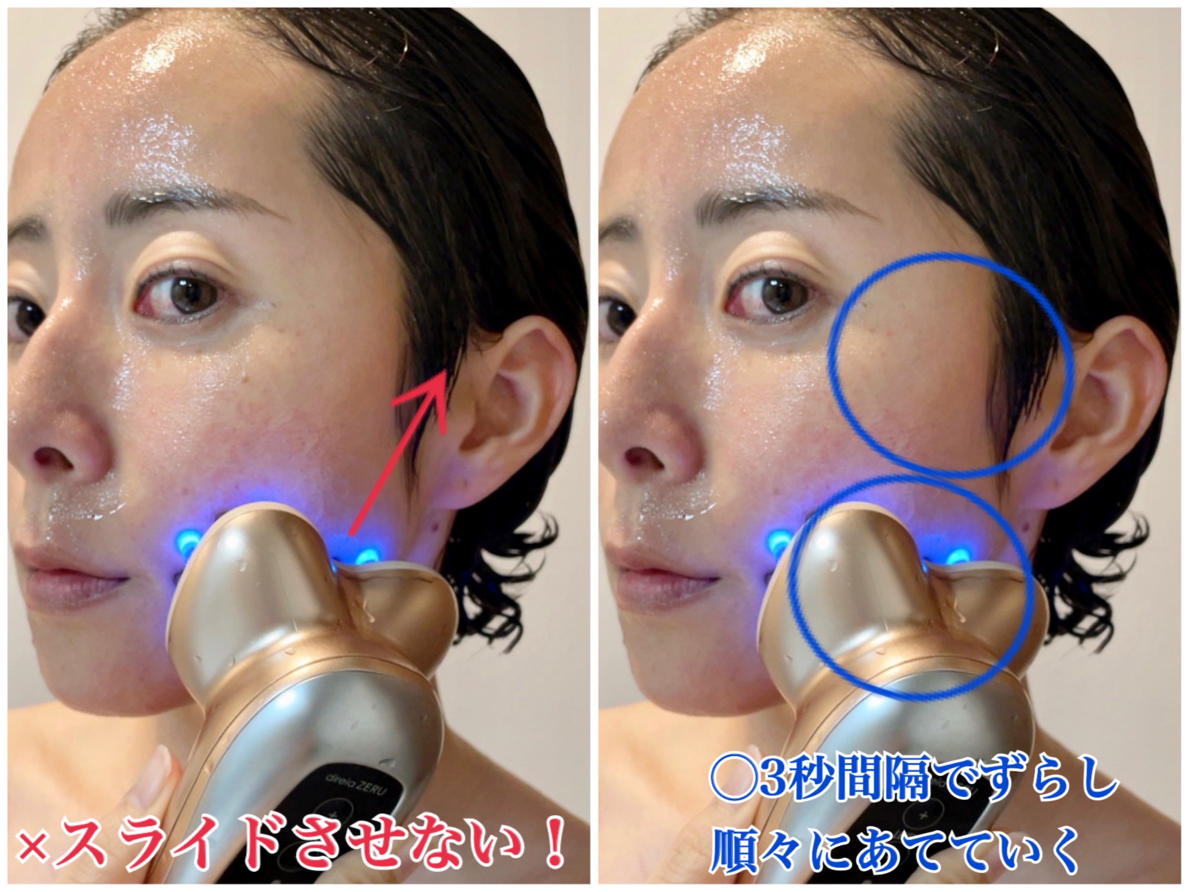 人生“最高級”EMS美顔器ディレイア ゼル！毛穴・美肌・頭皮・全身に