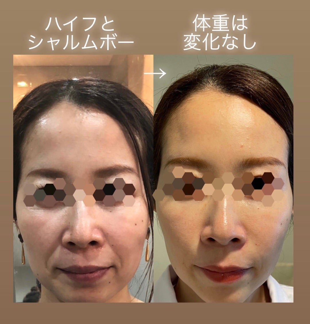 シャルムボーがどの様にして肌を綺麗にしてくれるのか | 京都【四条