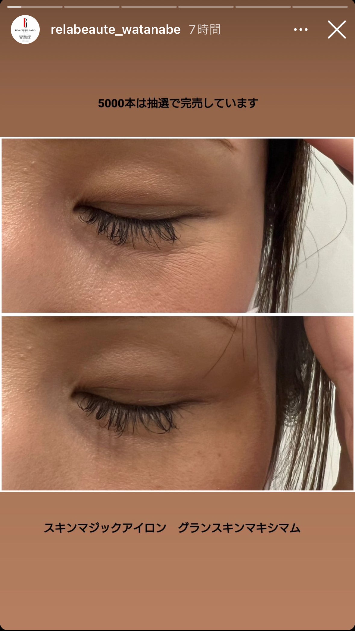 肌のたるみ・シワにアイロンをかける美容液アイクリーム 限定品 リア