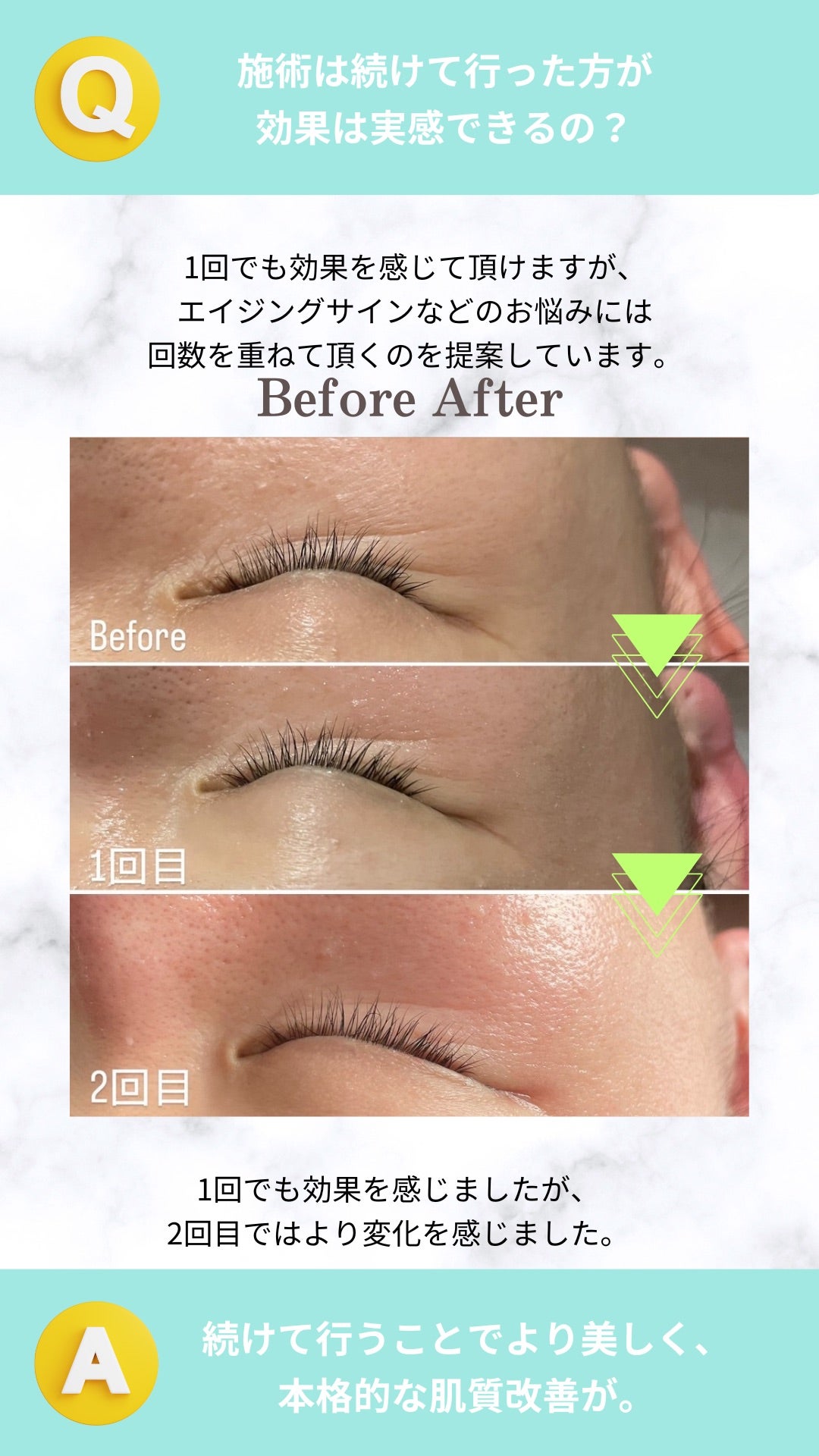 新メニュー ラミネーションピール ② | 福岡市南区の美容室 レガーレ