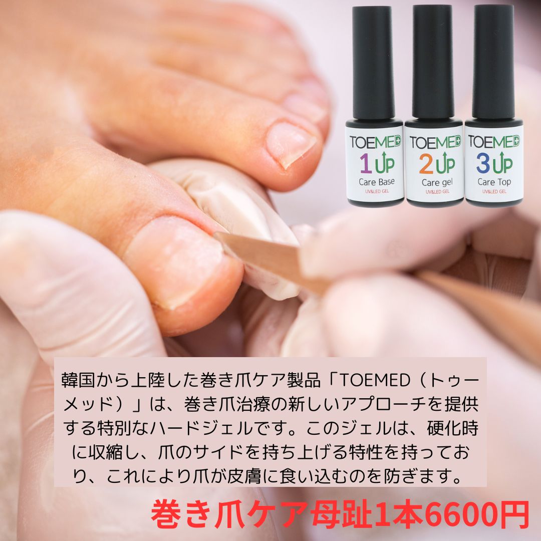 韓国発の革新的巻き爪ケアジェル「TOEMED」登場！美しい足元へ導く