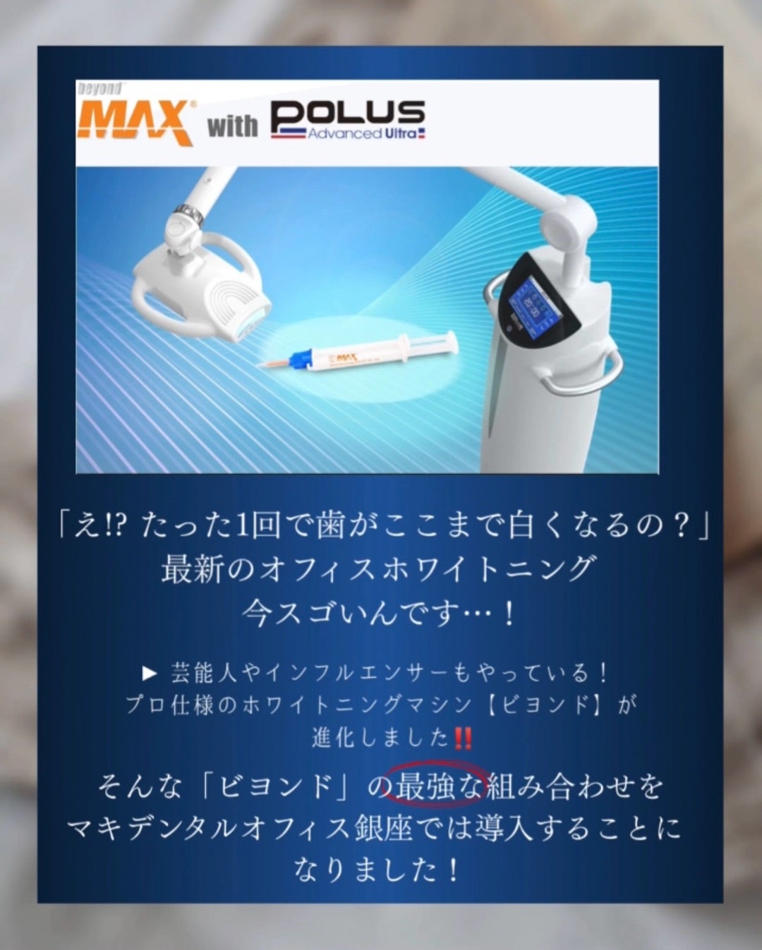 2025年最新情報！！】最先端のオフィスホワイトニングを導入しました