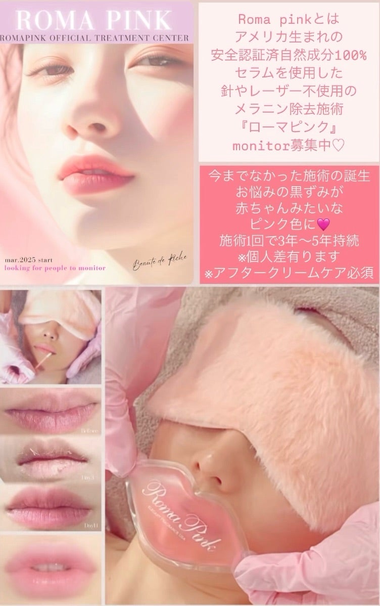 ローマピンク副作用と注意点⚠️ | ローマピンク・レモンボトル・光