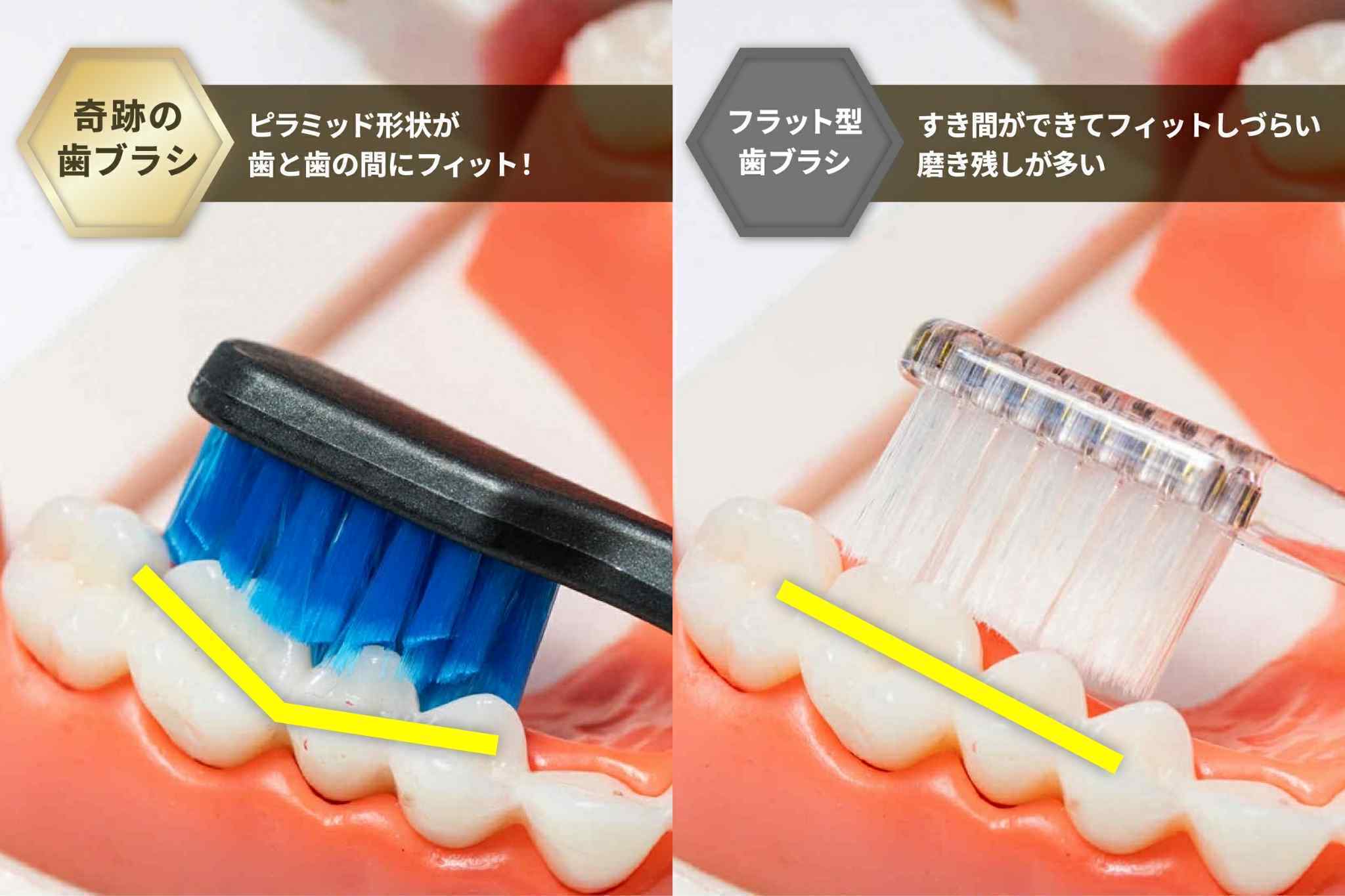 累計3000万本突破！歯科医が絶賛する「奇跡の歯ブラシ」が史上最強の5