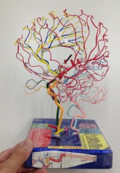 脳血管模型（作れない必要な人のために）教育用 TYPE.Hiro.No99