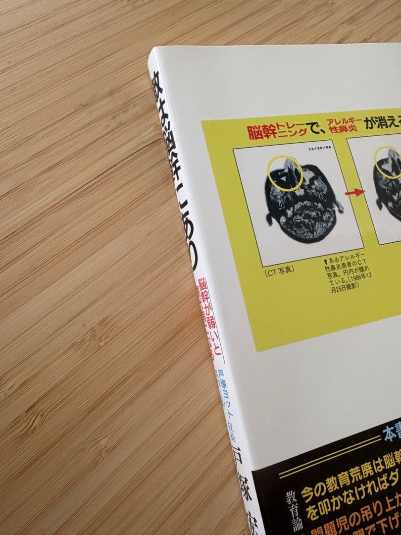 敵は脳幹にあり　戸塚宏著