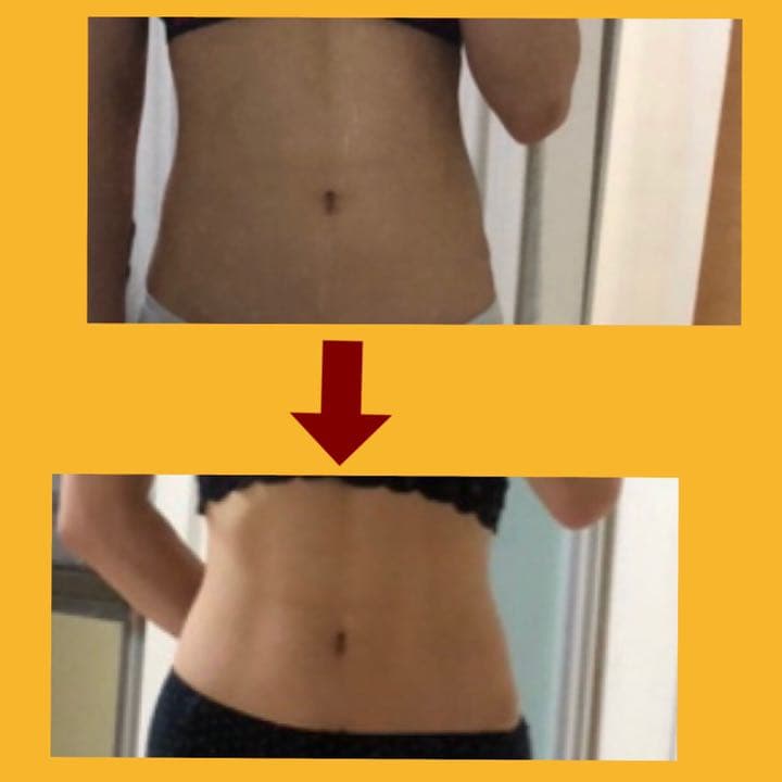 シェイプリフト　EMS ダイエット　スリムビューティーハウス テクノリンク シェイプリフト スリムビューティハウス EMS Shape lift