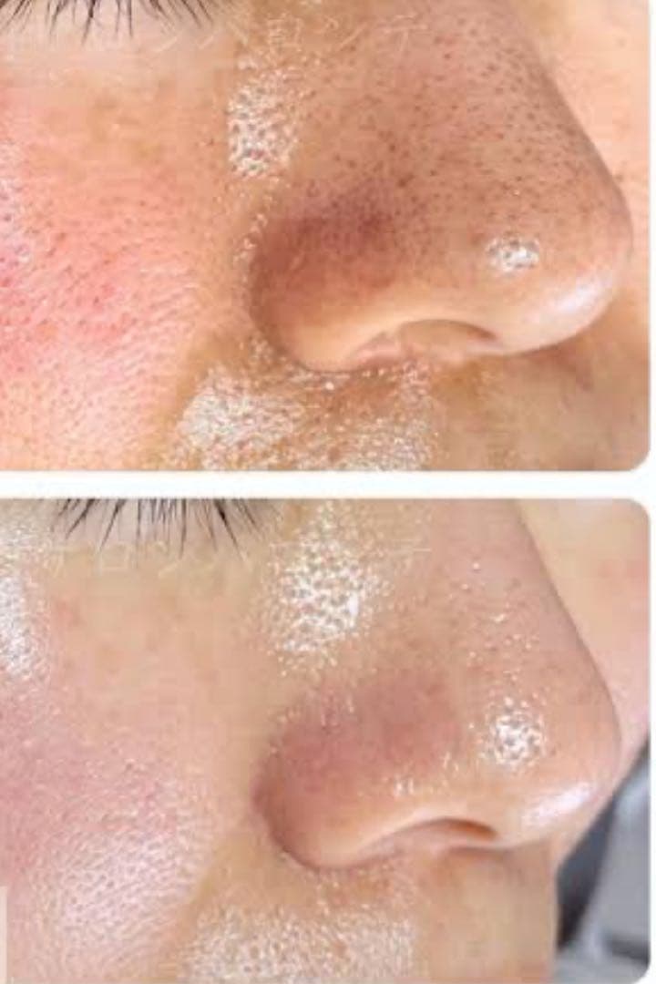 絶対乾燥しない保湿ジェル