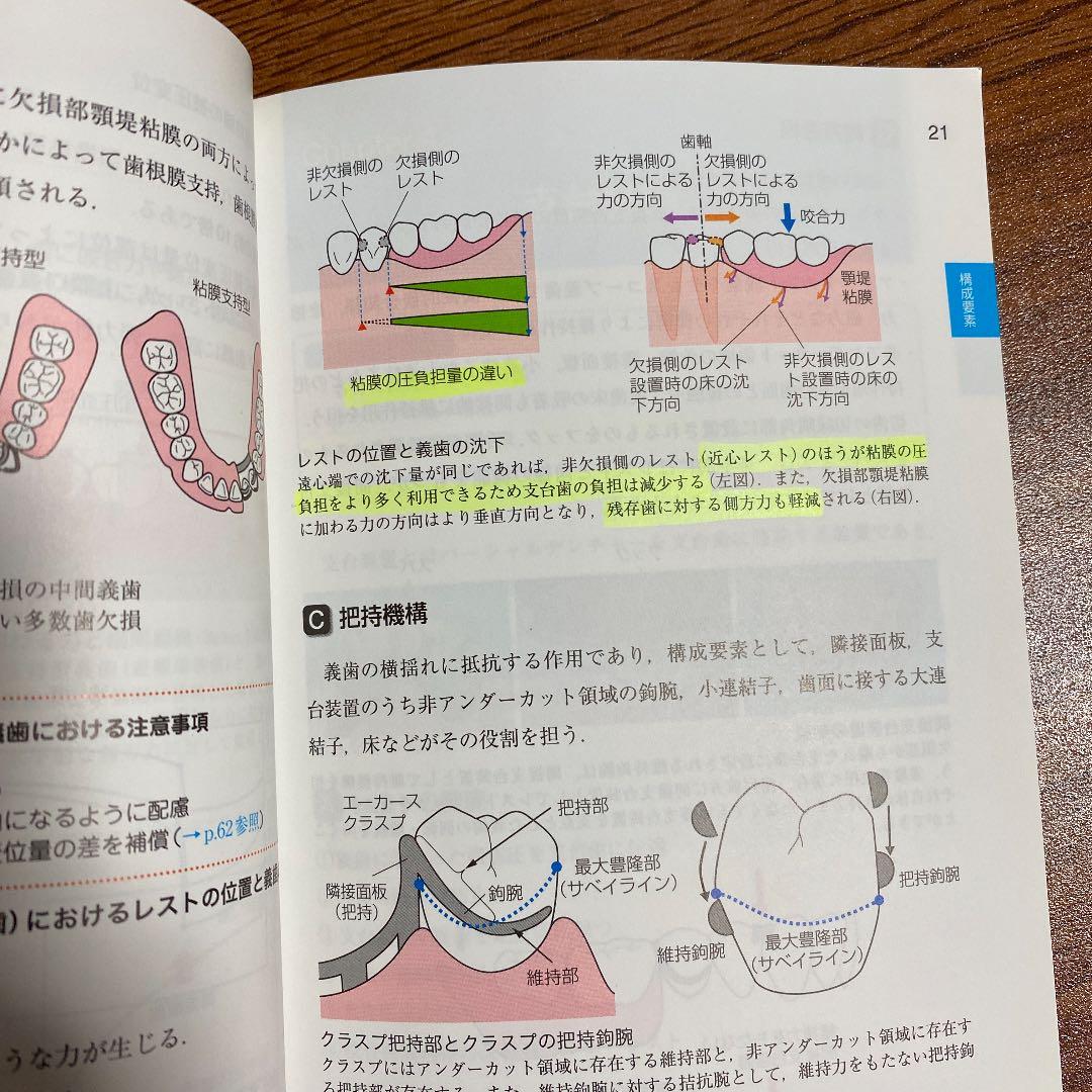 パーシャルデンチャー補綴学 - メルカリ