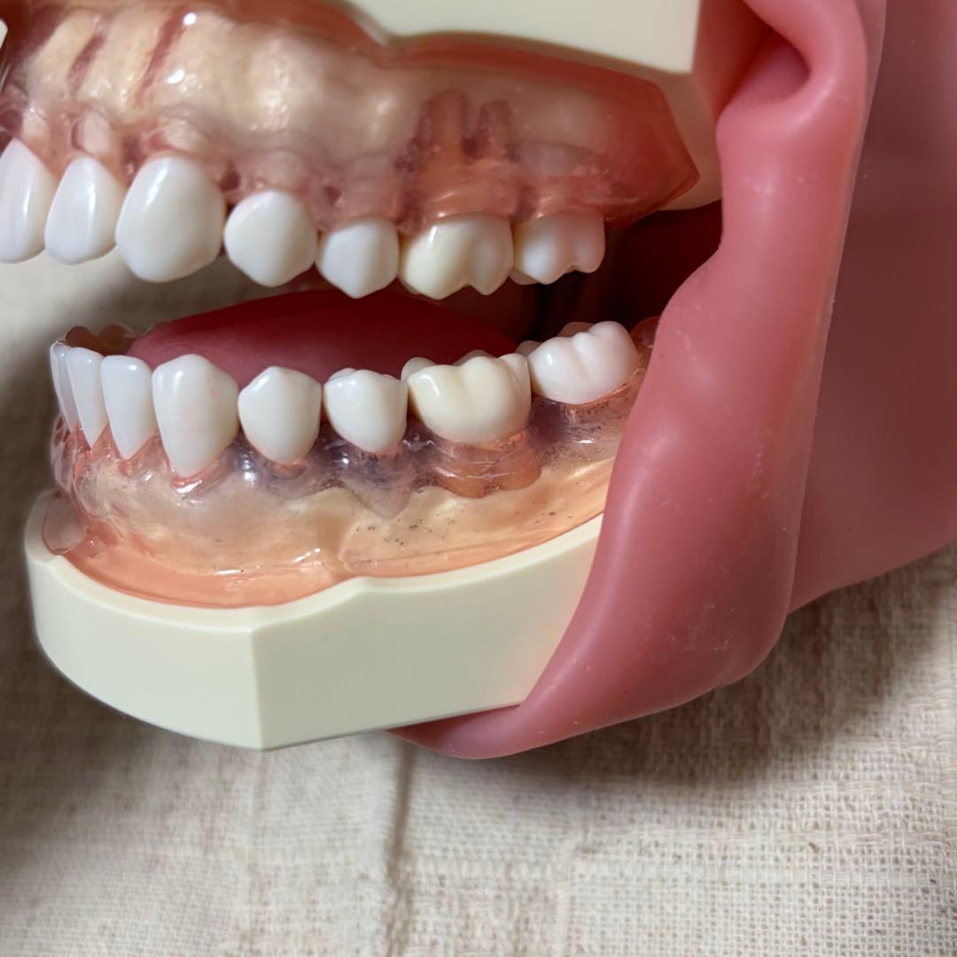 顎模型 頬粘膜付き 箱無し