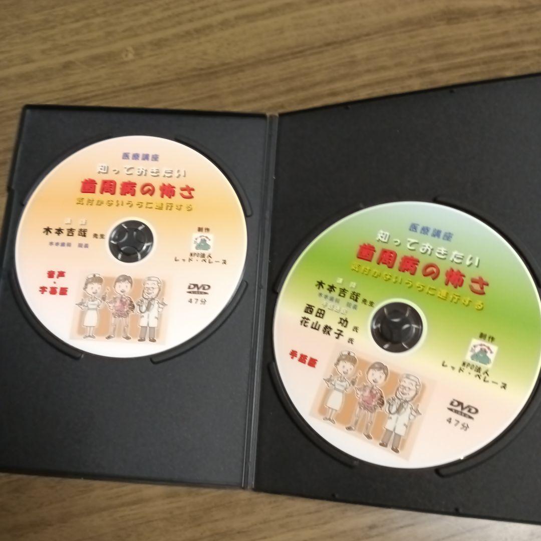 知っておきたい歯周病の怖さ DVD 2枚組