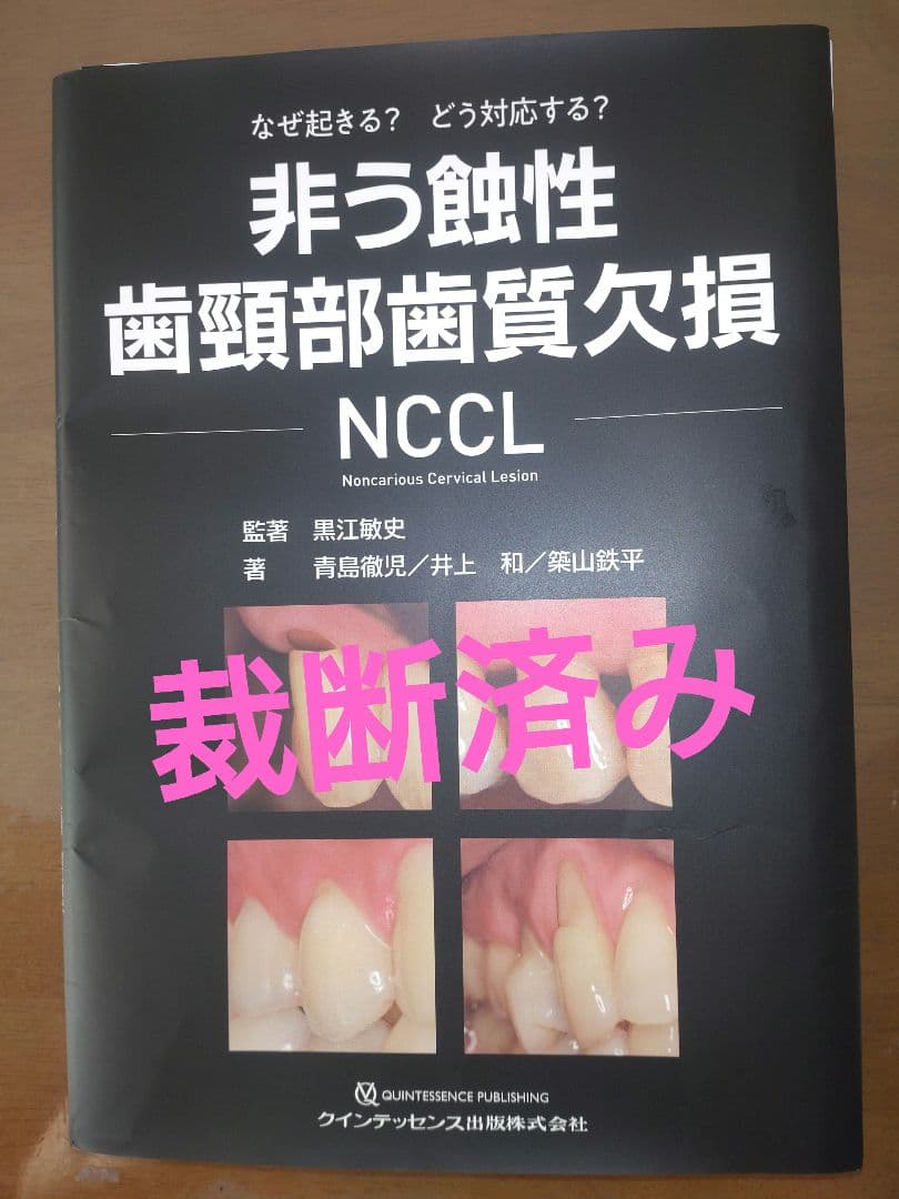 【裁断済み】非う蝕性歯頸部歯質欠損ＮＣＣＬ 非う蝕性歯頸部歯質欠損 NCCL : 有隣堂ヤフーショッピング店 - 通販
