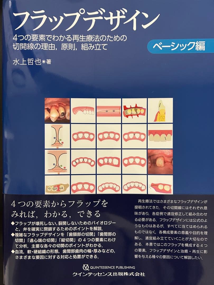 【裁断済】フラップデザイン : 4つの要素でわかる再生療法のための切開線の理由， フラップデザイン ベーシック編: 4つの要素でわかる再生療法のための