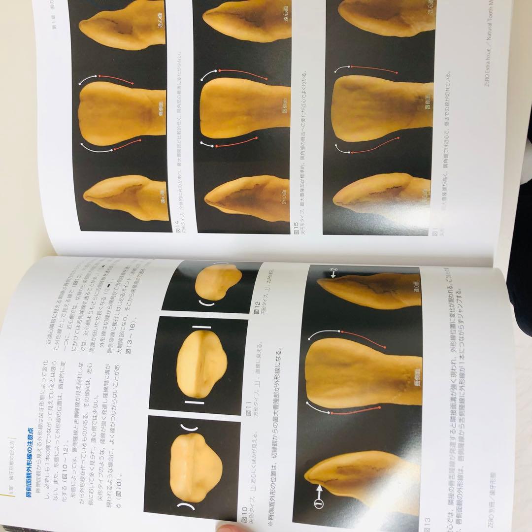 歯牙形態 歯科技工 歯科医師 審美 補綴 天然歯 解剖学 - メルカリ