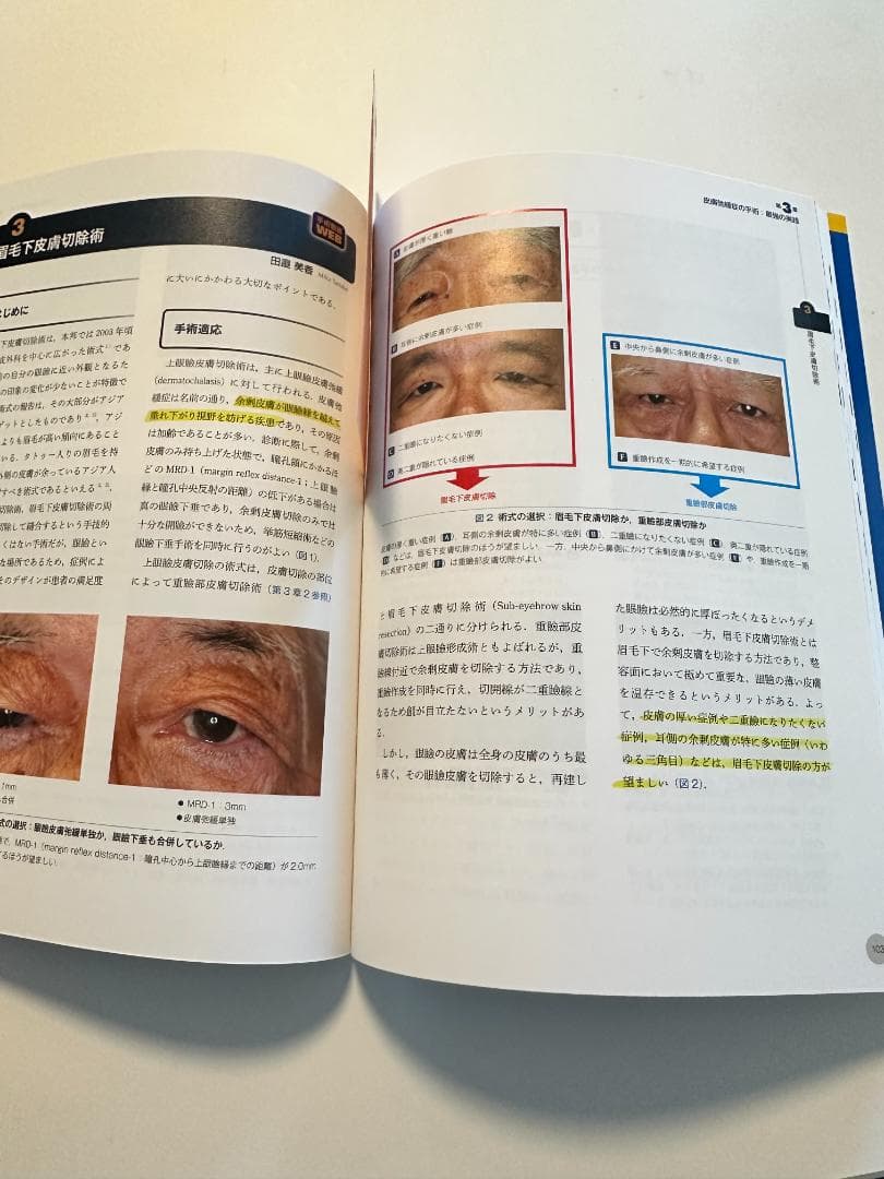 眼瞼手術の極意 小久保 龍一