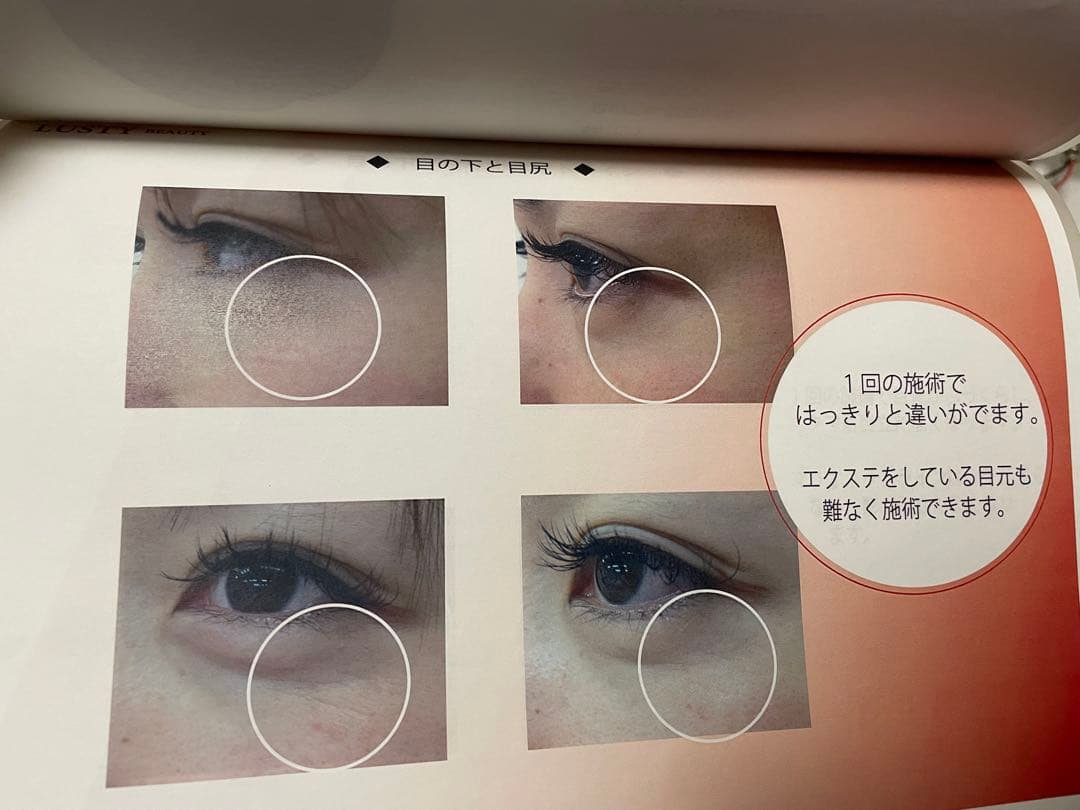 LUSTY BEAUTY 美顔器 エステ