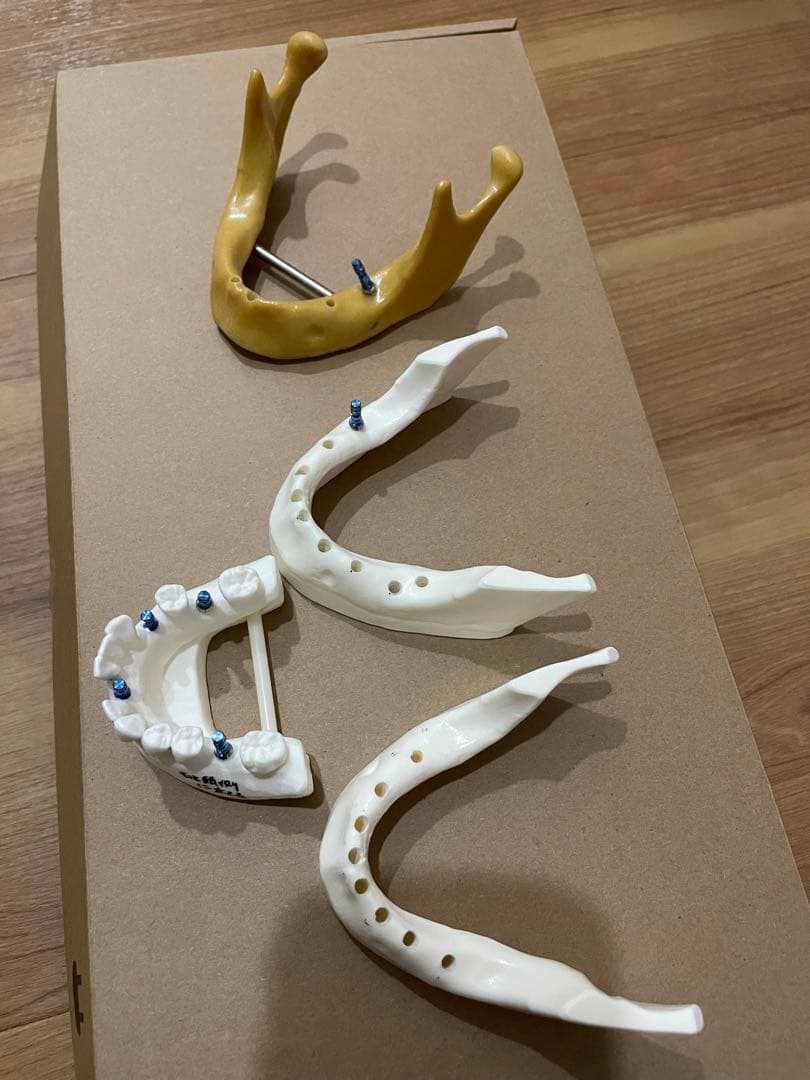 歯科模型 プラスチック製 透明歯列発育模型 [PE-PDI003(P12P-100C)]｜株式会社ニッシン｜歯科