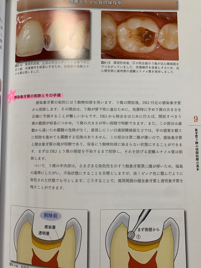 裁断済】1からわかるコンポジットレジン修復 - メルカリ