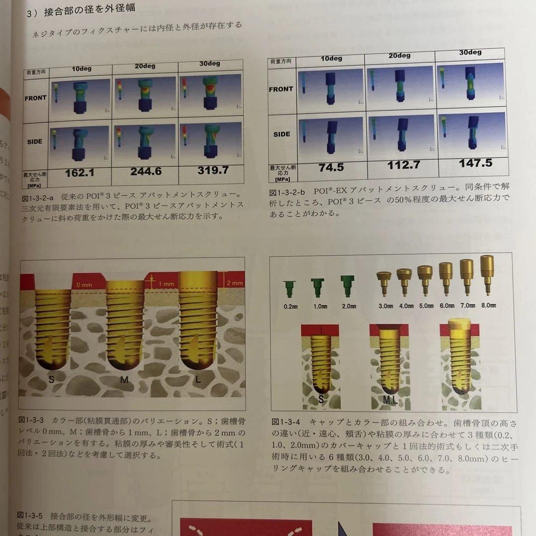 【希少】POI-EX SYSTEMの臨床 2006年版