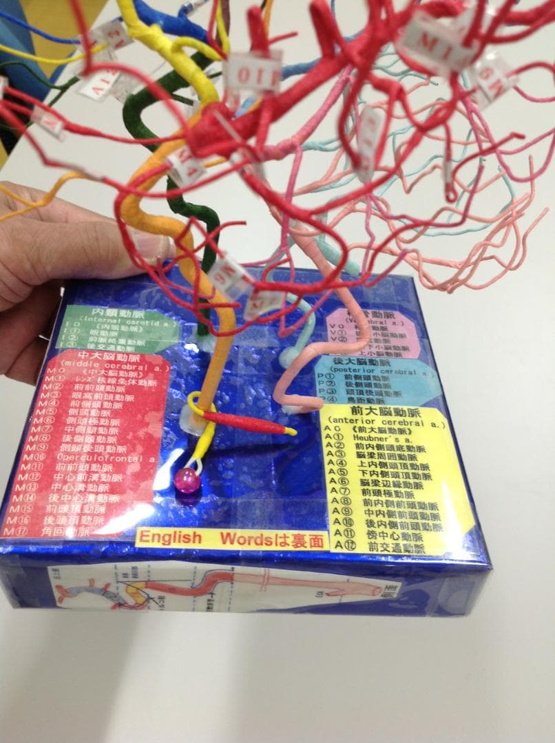 脳血管模型（作れない必要な人のために）教育用 TYPE.Hiro.No99