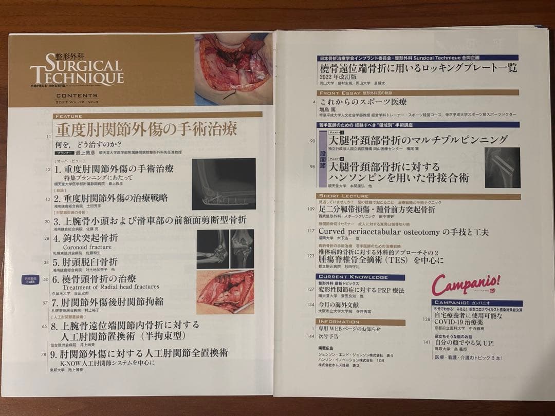 Surgical Technique 重度肘関節外傷の手術治療 - メルカリ