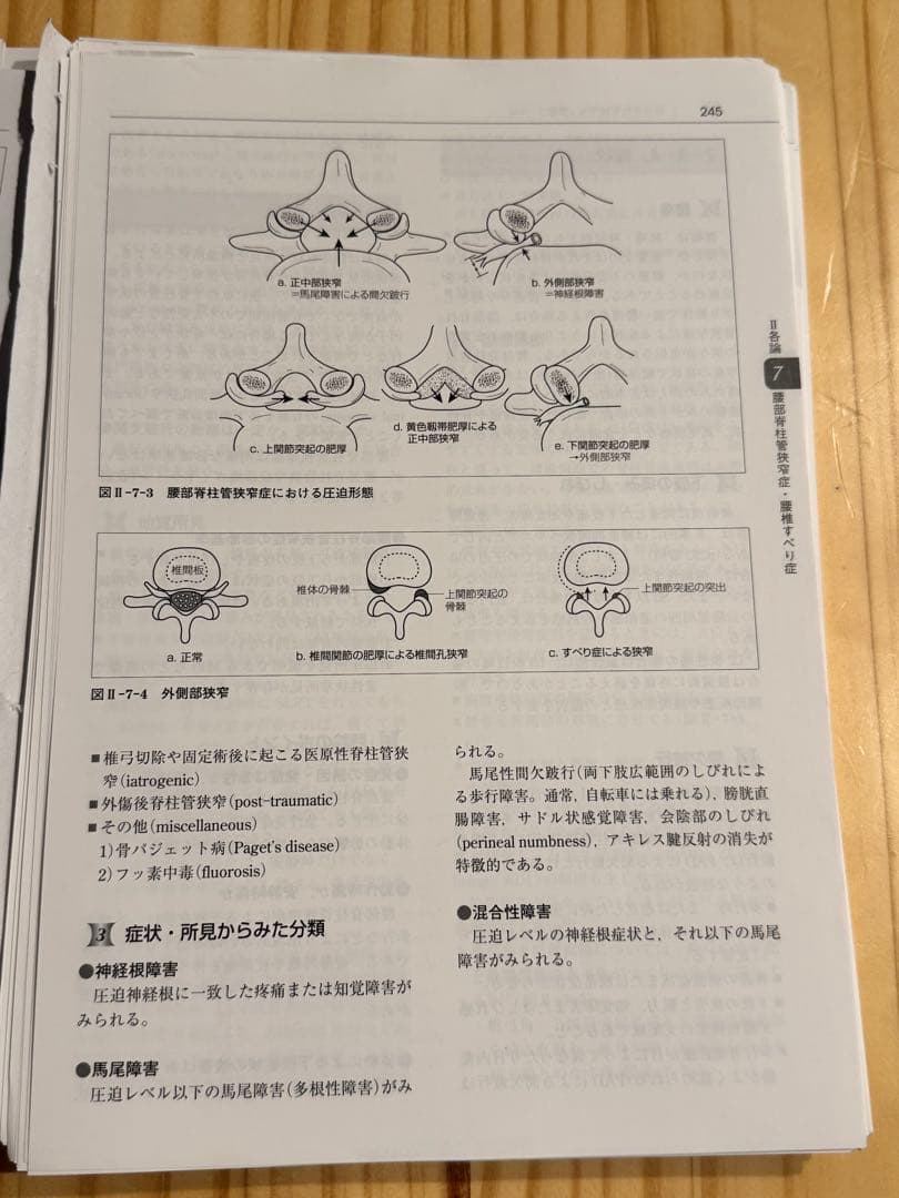 裁断済】脊椎脊髄病学(第3版) 裁断済】脊椎脊髄病学第3版 Amazon.co.jp