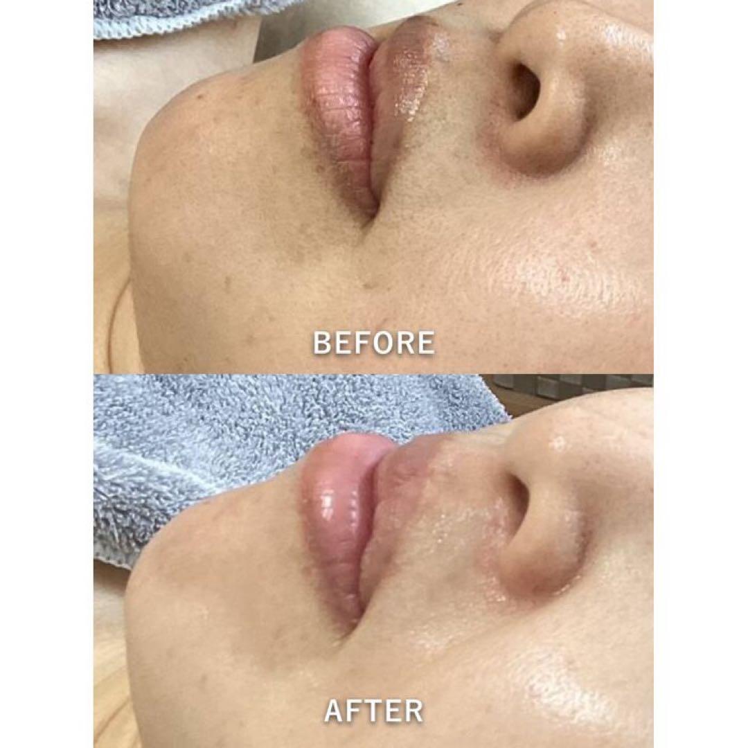 専用出品 もえか様