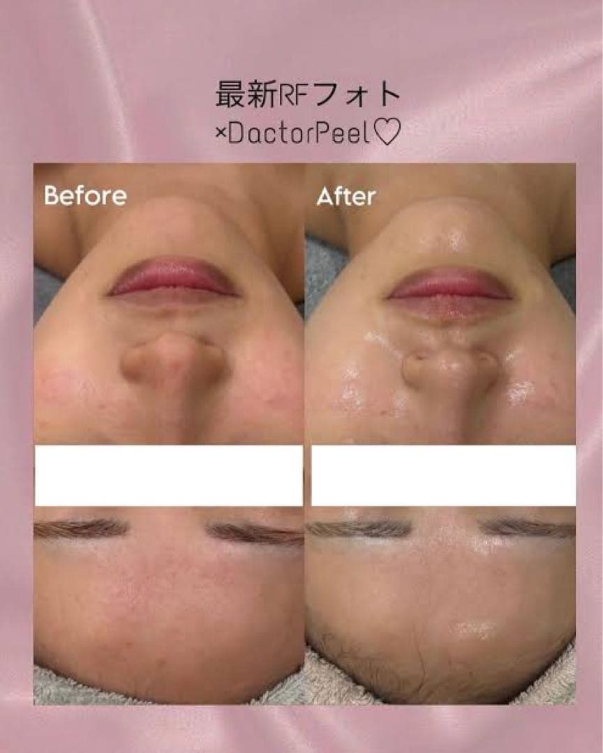 専用出品 もえか様